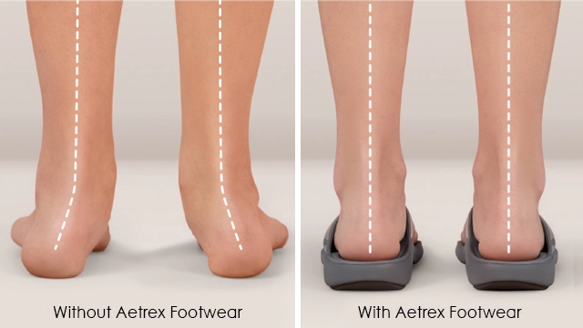 With or Without Aetrex Footwear