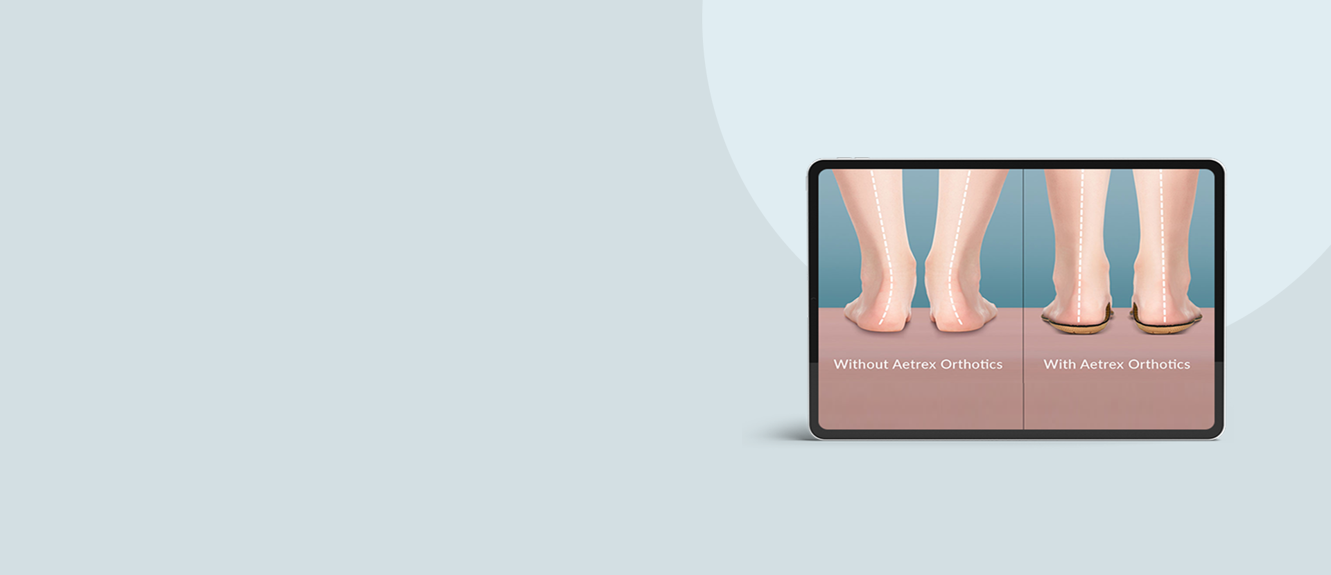 Tablet displaying a comparison of feet with and without Airex Orthotics on a light gray background.