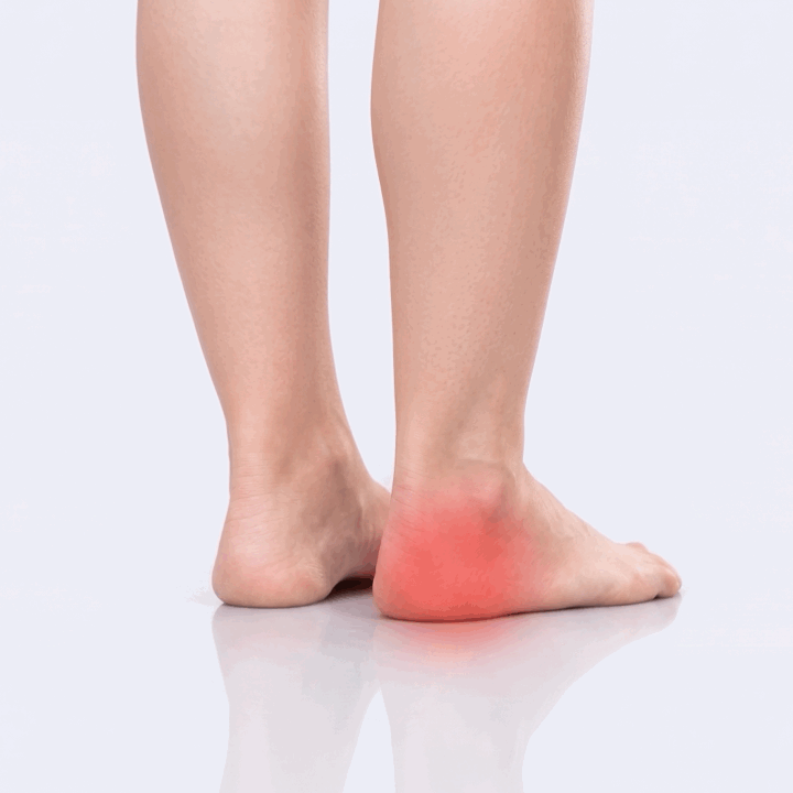 red pulsing dot over heel indicating heel pain