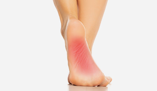 Arch pain