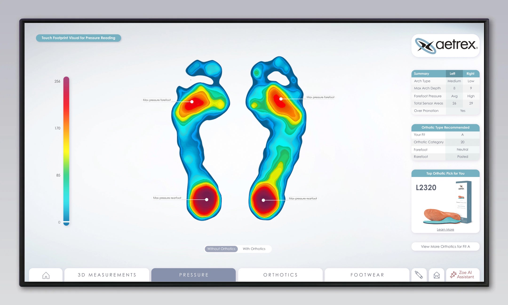 Aetrex foot scanning software displaying a color-coded heatmap of a foot