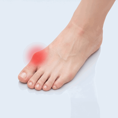 image of pain showing on the bunions of a foot