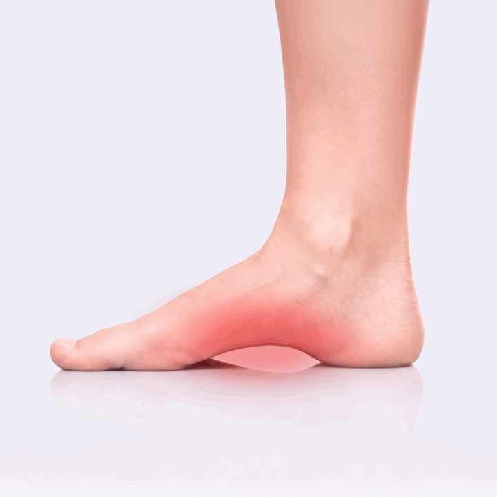 image of foot in pain with in arch of foot