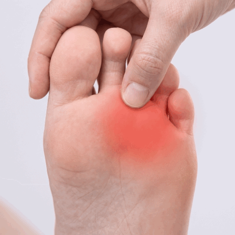 red pain indicating pain under the 3rd and 4th toe indicating morton's neuroma