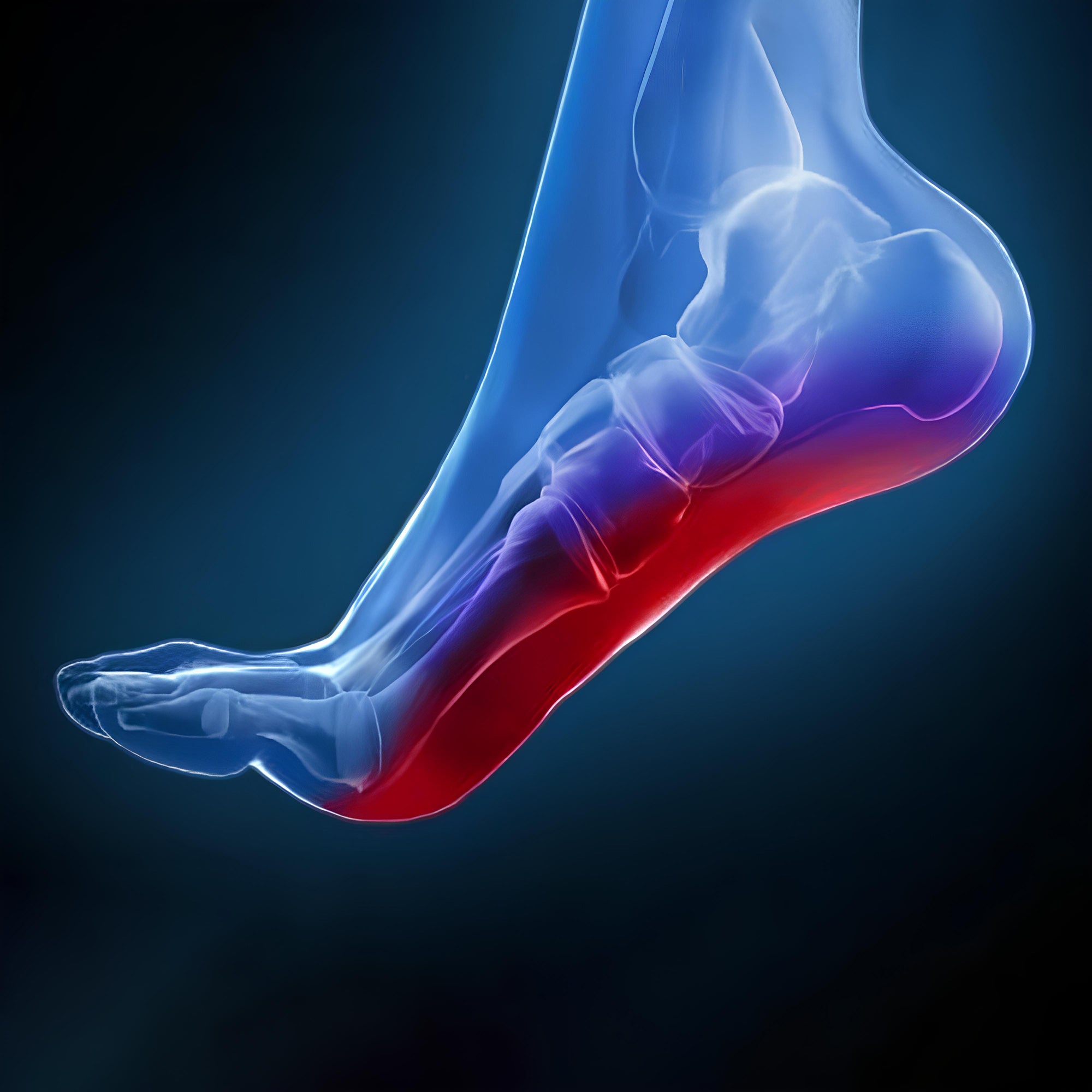 plantar fasciitis in foot