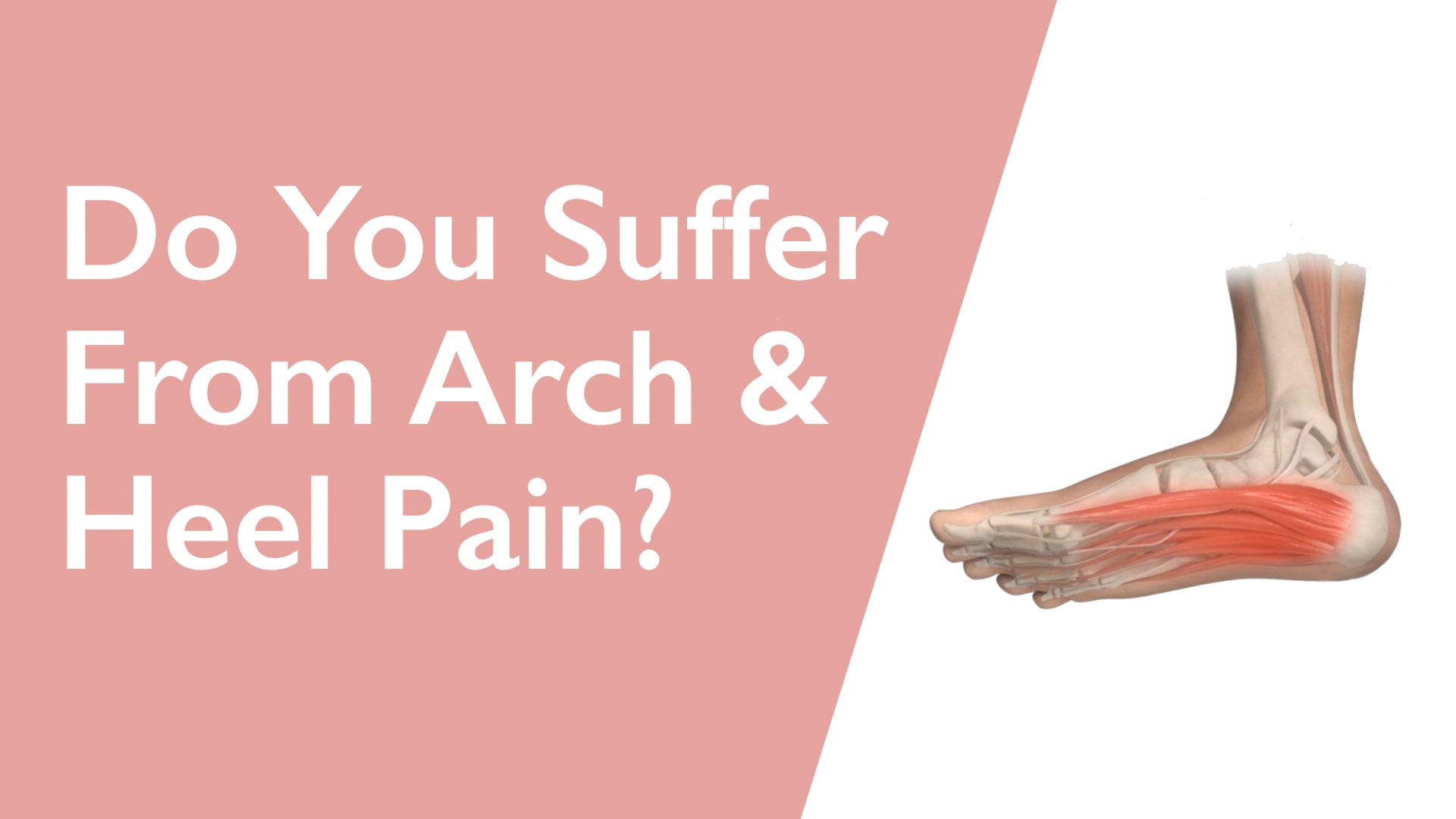 Foot with highlighted arch and heel pain on a pink and white background with text asking about arch and heel pain.