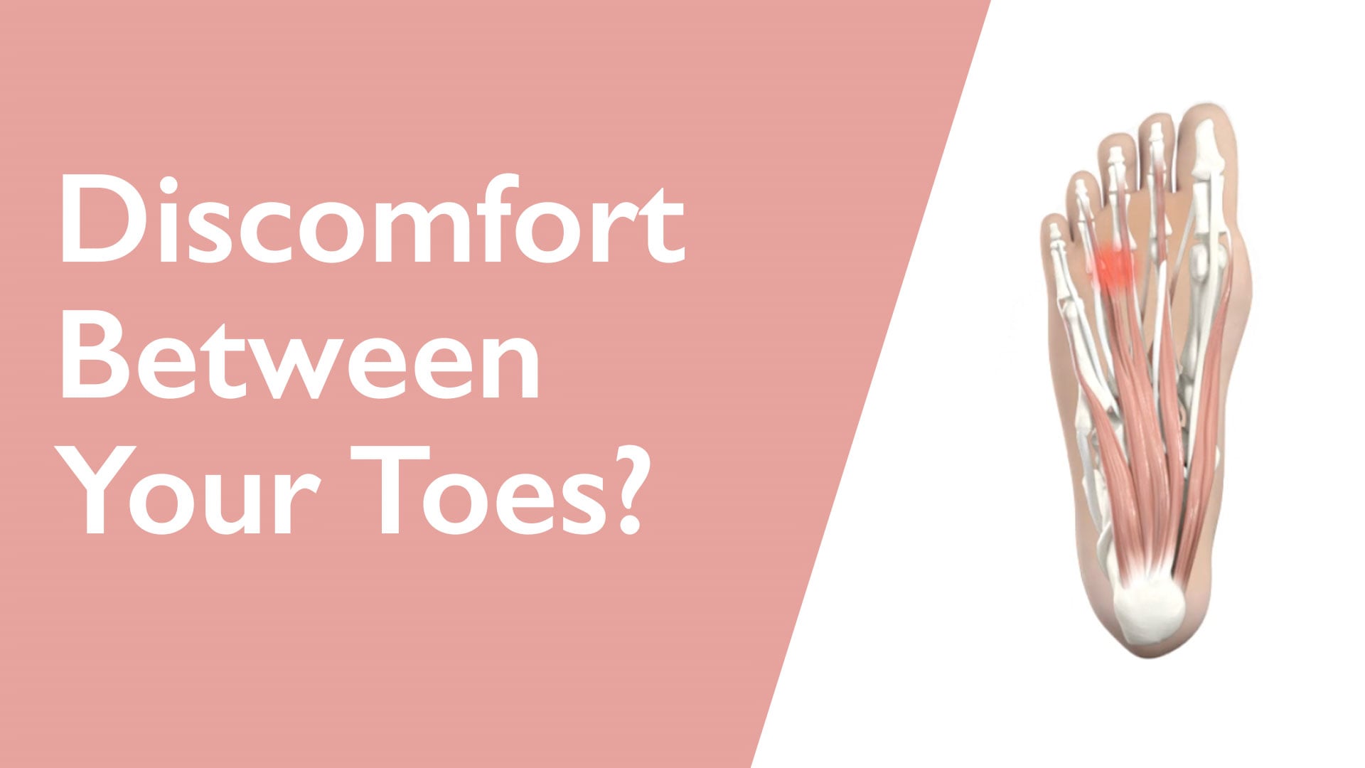 Illustration of toes with discomfort indicated and text 'Discomfort Between Your Toes?' on a pink and white background.