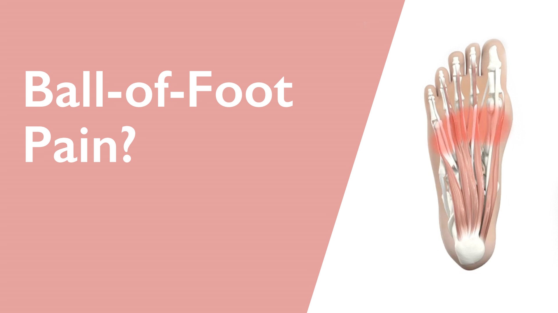 Illustration of a foot with highlighted ball-of-foot area on a pink and white background.