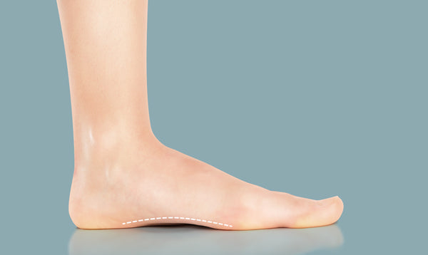 Orthotics for Flat Feet