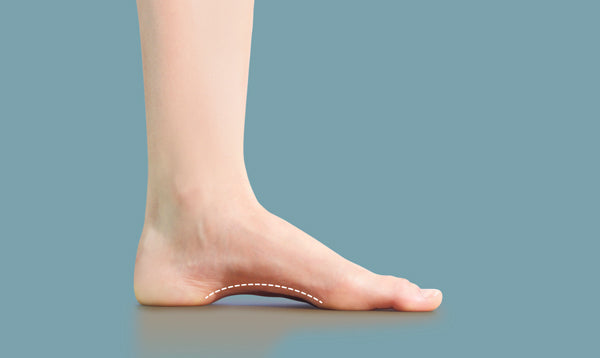 Orthotics for High Arches