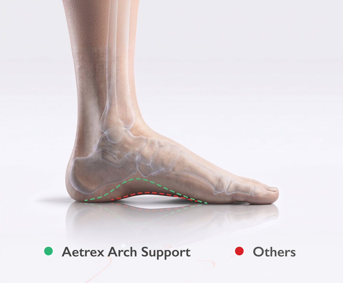 An anatomical illustration of a human foot and ankle with a curved arch support diagram. The heel and midfoot are shown in a dorsiflexed position, with translucent bone rendering.