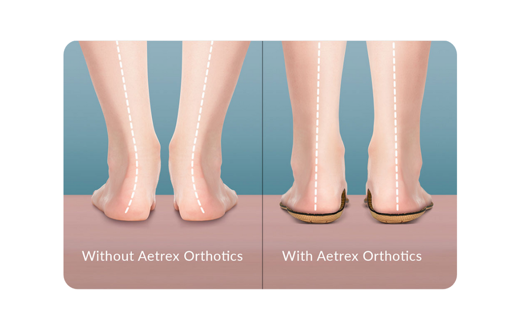 Foot Pain Relief