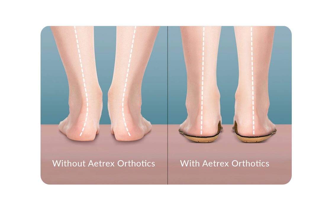 Foot Pain Relief