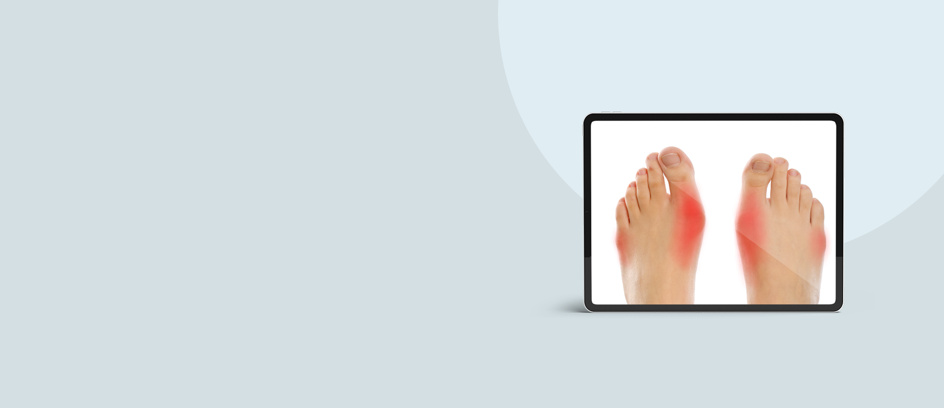 Digital display showing a close-up of feet with red patches on a light blue background