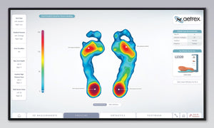 Zoe Pro: Revolutionary 3D Foot Scanner Technology | Aetrex – aetrex