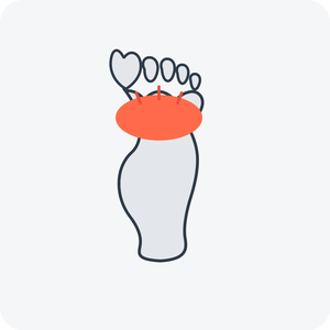 Ball of Foot Pain