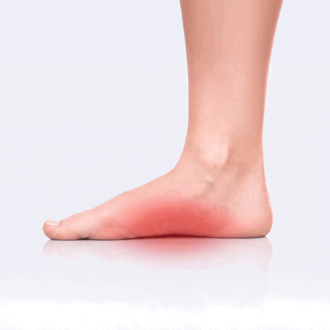 image of pain showing on the arch of the foot