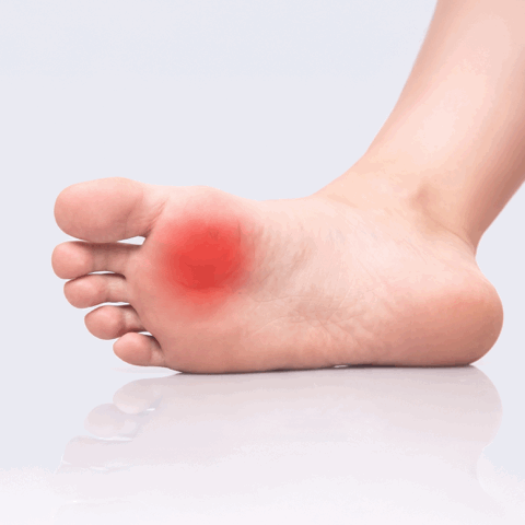 image of pain showing on the forefoot of the foot