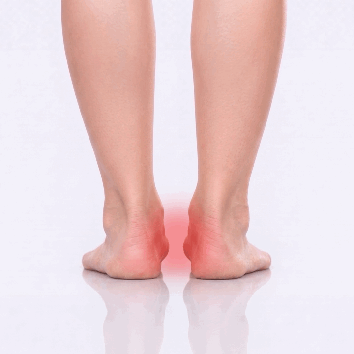 red pulsing dot over outside of foot indicating overpronation