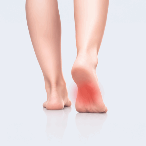 image of pain showing on the arch of the foot