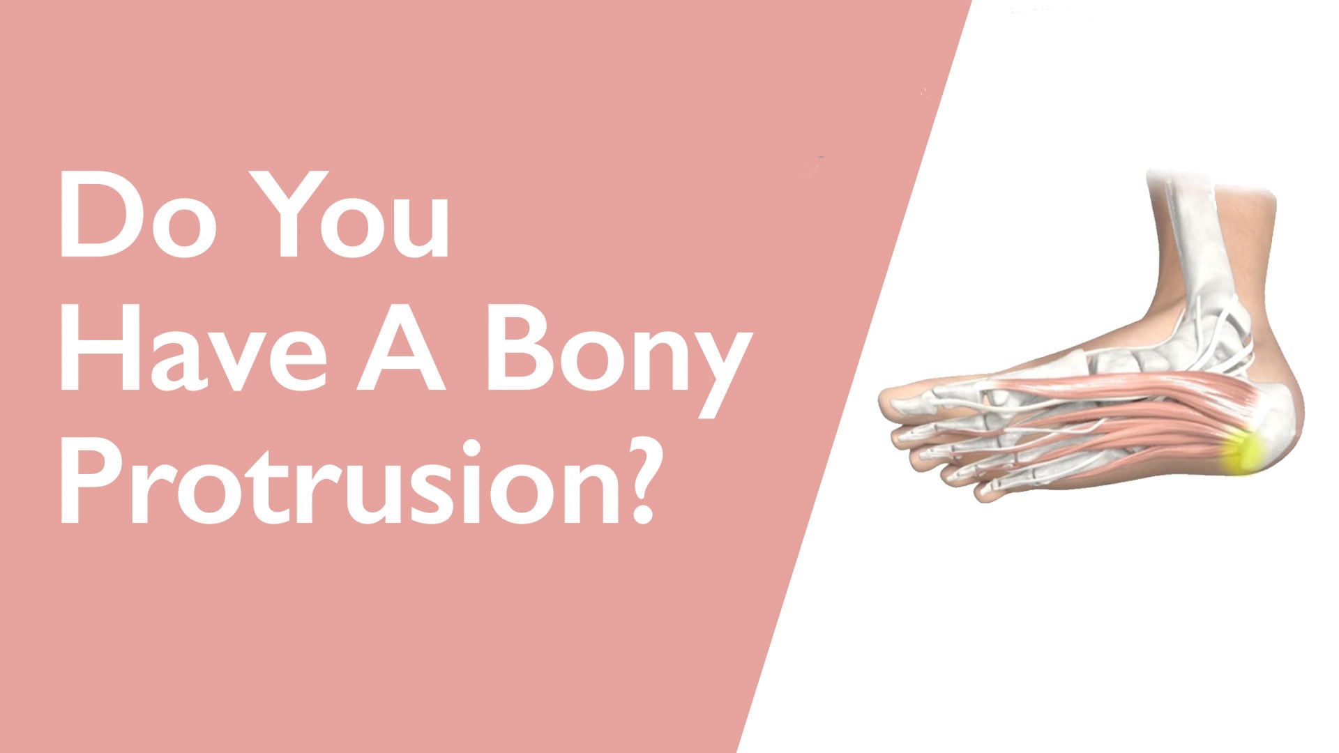 Illustration of a foot with a bony protrusion on a pink background