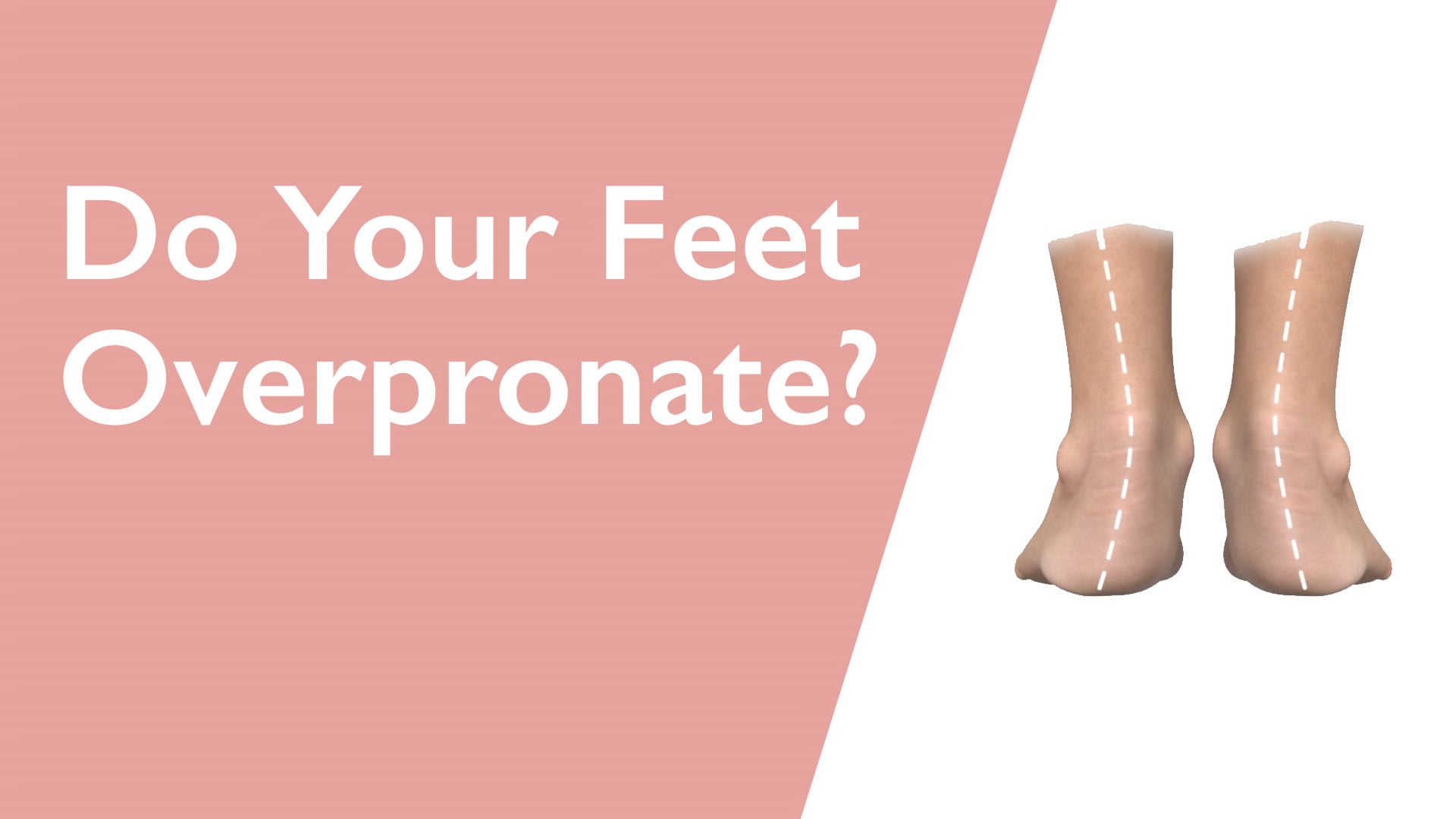 Pair of beige ankle socks with text 'Do Your Feet Overpronate?' on a pink and white background