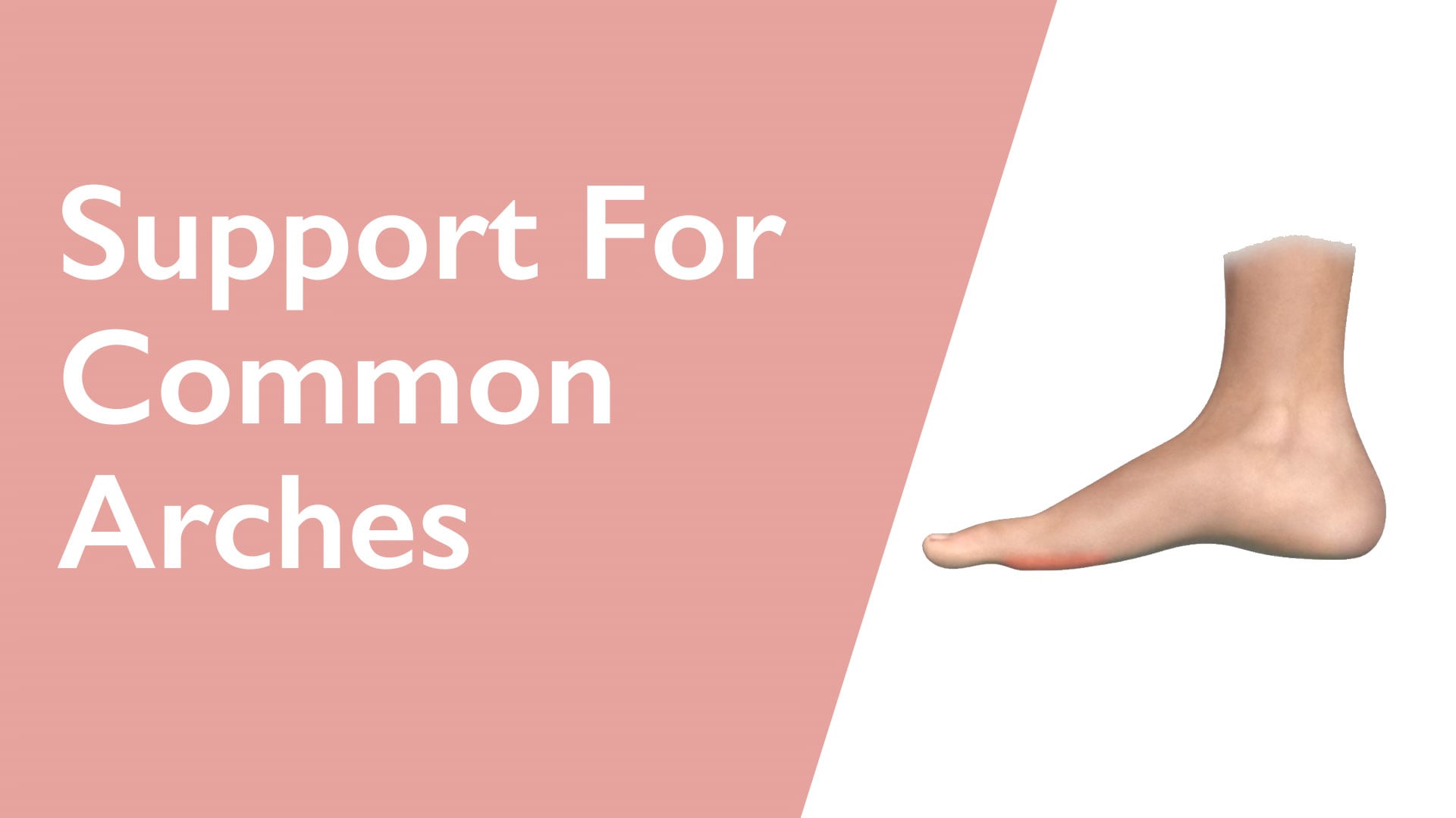 Foot with text 'Support For Common Arches' on a pink and white background