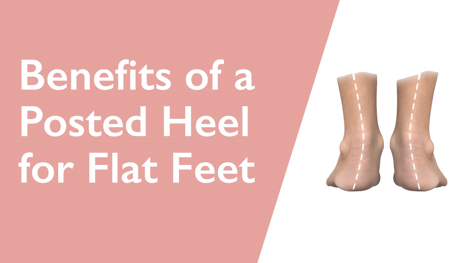 Pair of beige socks with posted heels on a white background, text 'Benefits of a Posted Heel for Flat Feet' on pink background.