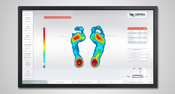 Foot Pressure Mapping Sample Result