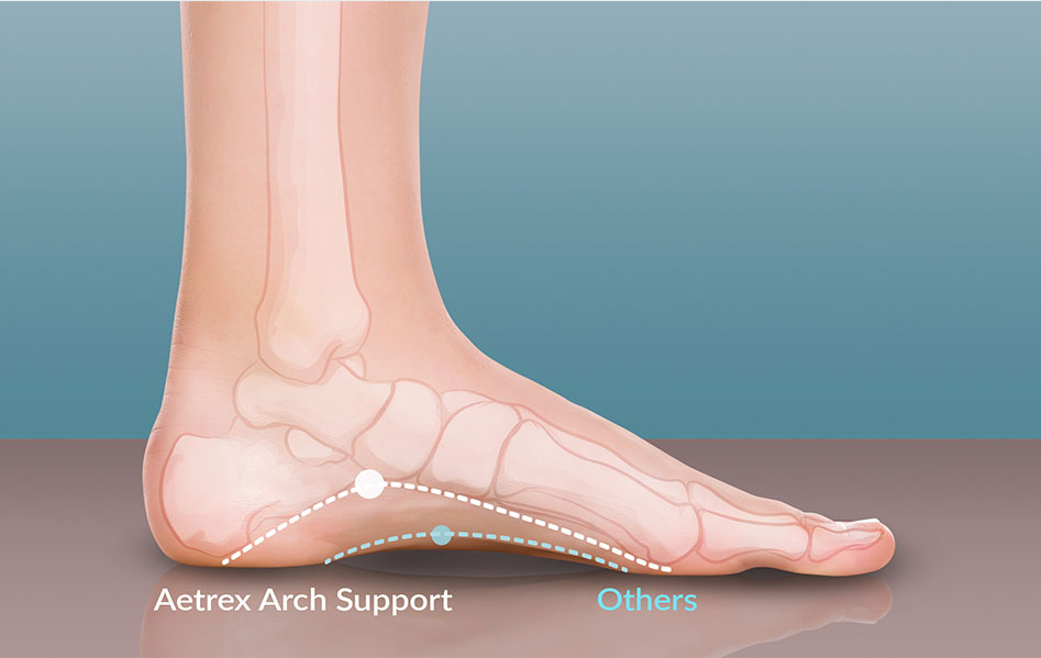 Orthotic Shoe Inserts for Plantar 